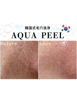 毛穴ケアをしたい