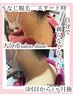 うなじ脱毛ご新規様☆２か月以上経過した方もこちらから☆