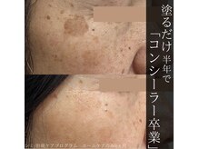 アウラプラス(Aura+)の雰囲気（その場限りではなく”根本改善”を目指しています）