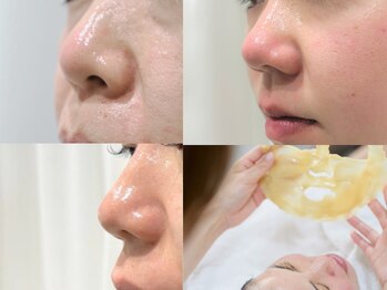 マイ フェア レディ(MY FAIR LADY)の写真/顔の産毛を全て取り除き、毛穴の開き、黒ずみに特化したケアで自分史上最高の"つるん肌へ"