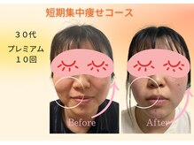 ヨサパーク リボーン(YOSA PARK Reborn)/劇的ビフォーアフター/痩身駒込