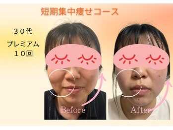 ヨサパーク リボーン(YOSA PARK Reborn)/劇的ビフォーアフター/痩身駒込