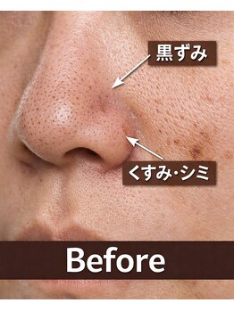 フォーグッド(forgood)/黒ずみで老け見え？