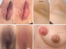 エルビービュティーサロン(LB BEAUTY SALON)の雰囲気(関西症例数No. 1を誇るメラニンケア☆ルメラ/黒ずみケア)