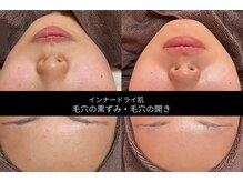 ホワイトラボ 川西(White labo)の雰囲気(お肌のお悩みに合わせたケアですっぴんで過ごせる肌に肌質改善)