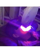 プラチナムビューティ 渋谷店(PLATINUM Beauty)/ホワイトニング