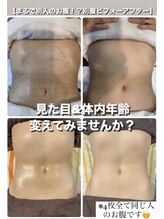 フルールドソレイユ(Fleur de Soleil)/今すぐ（見た目）マイナス３キロ