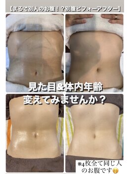 フルールドソレイユ(Fleur de Soleil)/今すぐ（見た目）マイナス３キロ