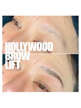 ヴィータ(VITA)/ハリウッドブロウリフト