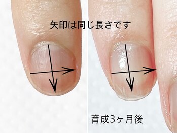 トゥインクリーネイルサロン(Twinkly Nail Salon)/【最強のネイルケア】1回お試し