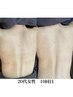 ハーブピーリング【背中】ザラつきが気になる方★剥離無し・あり選べる¥9,600