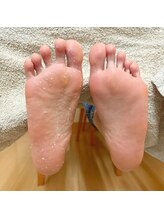 ヘアー ユニバース(HAIR UИIVERS)/簡単！15分の足裏角質ケア