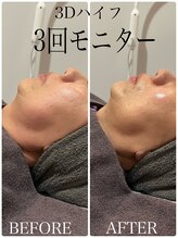 アンベール(unveil)/小顔