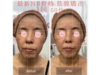リラクゼーションサロン ラキ(laki)/NR筋膜骨格調整フェイシャル1回