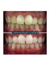 ホワイトニングショップ 所沢店/ホワイトニングショップ所沢店