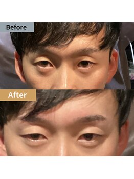 眉毛ハウス 吉祥寺店(眉毛HOUSE)/お客様の施術例(吉祥寺/東京)