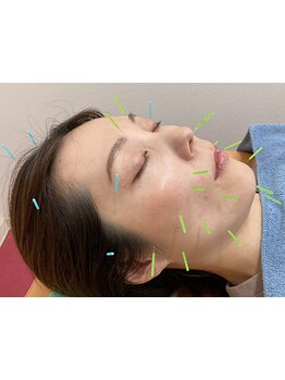 小顔になりたい