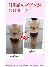 すばる整体院 小牧/before after/産後骨盤矯正/小牧