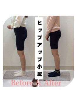 スタイルラボ高松/産後骨盤矯正の効果♪