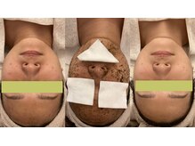 ミューズ 成城(MUSE)/