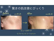 エステティック クオーレ ミサ ギンザ(ESTHETIC CUORE MISA GINZA)の雰囲気（大人の肌改善、シミケア&エイジングフェイシャルが好評！）