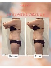 リシェル/体の厚み☆ビフォーアフター