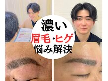 ビビ