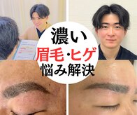 ビビ