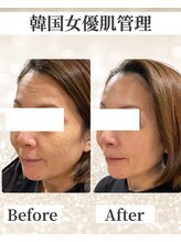 ドレス(dress)/たった1回でシワ改善