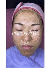 ルミナス(Luminous)/ハーブピーリング