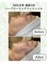 シーフェイス 横浜店(SEE FACE)/凝りたるみむくみくすみ毛穴ケア