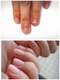 ココ ネイル サロン アンドスクール(COCO.NAIL SALON＆SCHOOL)の写真/爪を噛む癖、やめたいけどやめられない…そんなあなたへ。もう隠さなくていい、“見せたくなる指先”に！