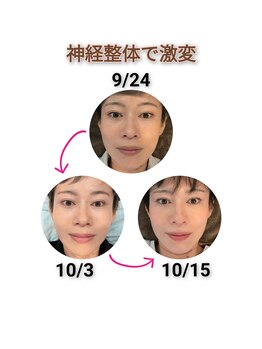 そら/小顔　小顔矯正