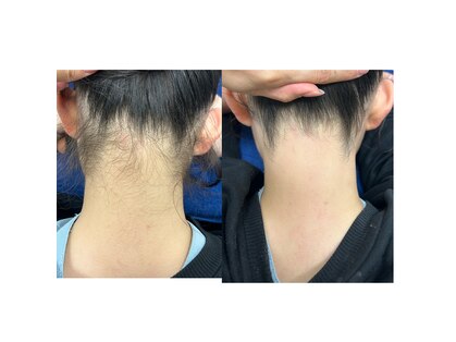 ソラ(SORA)の写真