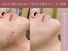 フェイシャル専門店 エピア 掛川店(Epia)