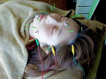 PUNAYU【鍼灸 | アーユルヴェーダ】/やさしい電気美容鍼灸