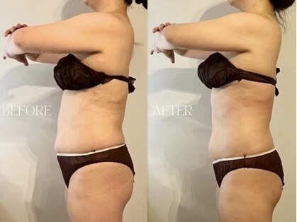 ラティボ 学芸大学(LATIVO)の写真