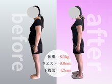 みくる整骨院 美容整体 &nbsp;清須の雰囲気（無理な食事制限なし/運動なし/リバウンド低/北名古屋/西区/あま）