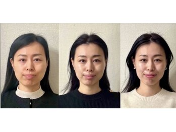 キュープ 富士店(Qpu)の写真/「続けたい！」のお声多数！回数券でお得に通うこともできます◎長く通えるお気に入りサロンにぜひ。