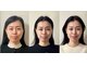 キュープ 富士店(Qpu)の写真/「続けたい！」のお声多数！回数券でお得に通うこともできます◎長く通えるお気に入りサロンにぜひ。