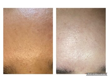 オアジスパ(Oasi Spa)/