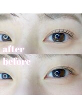 バトン(BATON.)/before / after