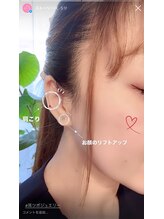 アルバ暁子鍼灸治療院(alba暁子鍼灸治療院)/耳つぼジュエリー