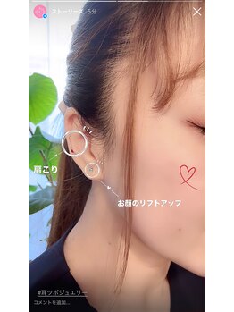 アルバ暁子鍼灸治療院(alba暁子鍼灸治療院)/耳つぼジュエリー