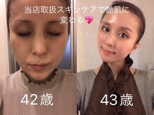 ナナラ(nanala)の雰囲気（当店の取り扱いスキンケアで艶肌に変わる！）