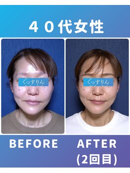 ぐっすりん/複数回継続のお客様の変化(11)