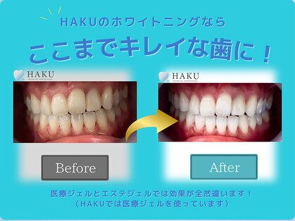 ハク 武蔵小杉店(HAKU)の写真