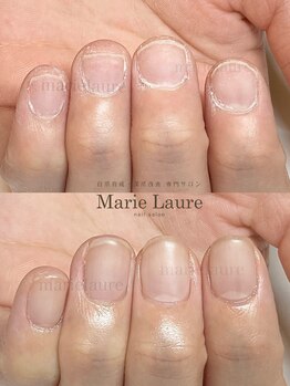 マリーロール 淀屋橋本店(Marie Laure)/自爪育成/深爪矯正/ネイルケア