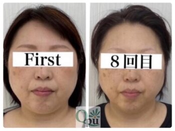 キュープ 小倉店(Qpu)/通常コース8回での変化