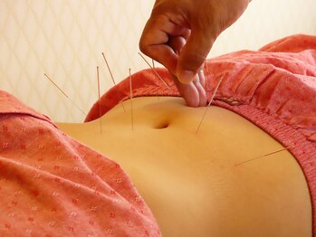 プロぺ鍼灸整骨院/ダイエット鍼・妊活[鍼灸]